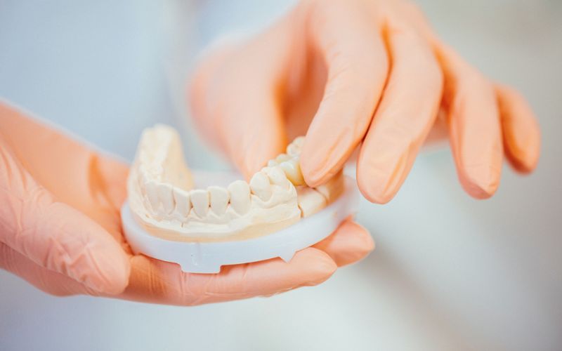 Abbildung einer Zahnprothese