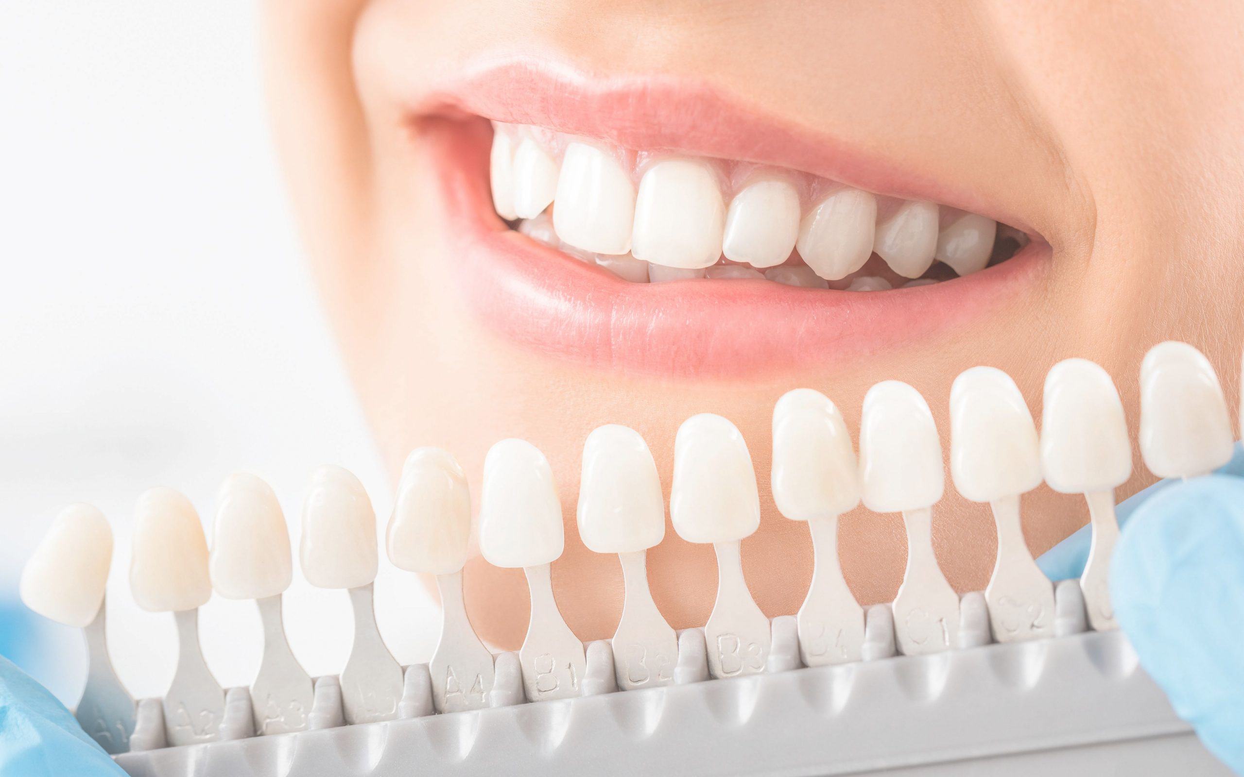 Zahnfüllung - Dr.Sach - Ganzheitliche Zahnarztpraxis Frankfurt