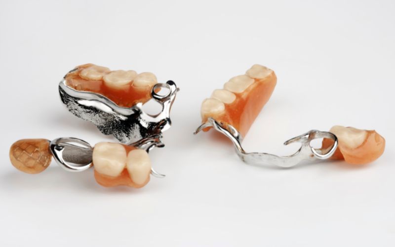 Abbildung Herausnehmbare Zahnprothese